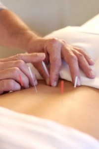 Acupuncture Weight Loss 