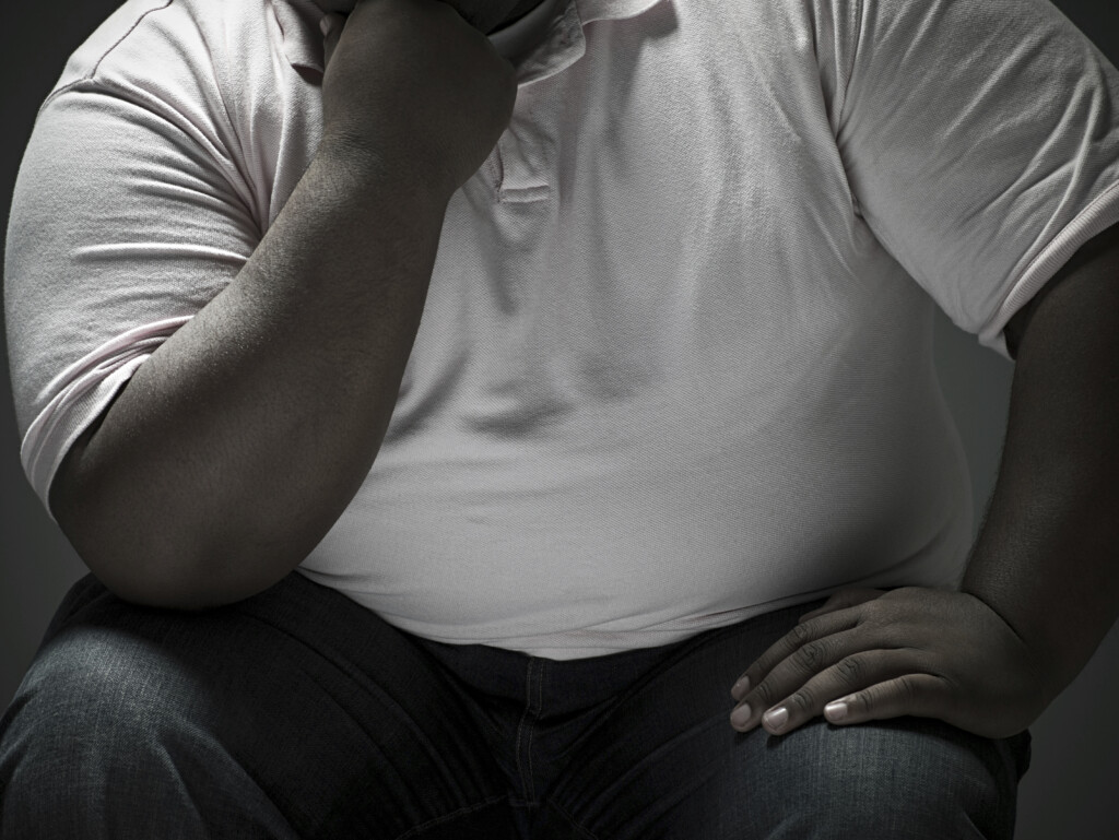 Bariatric Surgery, something worth considering